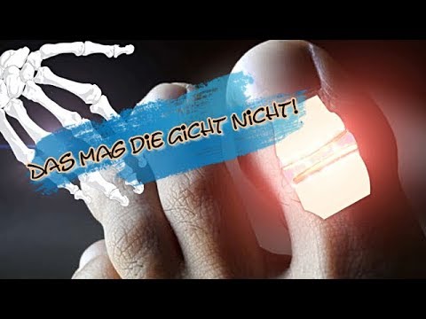 Video: Diät Gegen Gicht - Diätmerkmale, Empfohlenes Menü, Rezepte