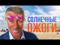 Солнечные ожоги. Тепловой и солнечный удар. Помощь и что делать - Доктор Комаровский