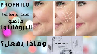 البروفايلو   حقن البروفايلو لشد الوجه   profhilo injection technique