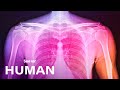 Connective Tissue and Its Complexities