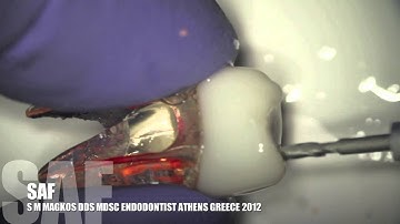 SAF (SELF ADJUSTING FILE)