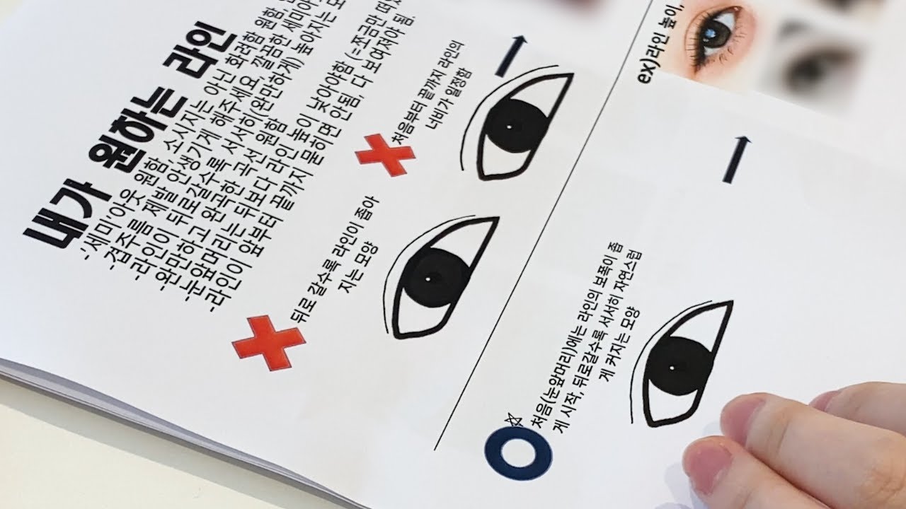 [Вондерфул Гоо сайхны мэс засал] Давхар зовхины мэс заслын өдөр PPT бариад ирсэн үйлчлүүлэгч... мэс заслыг зогсоох хүртэл!