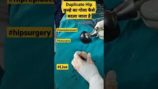 Duplicate Hip कुल्हे का गोला कैसे बदला जाता है | #hipreplacement #avascularnecrosis #hippain #mbbs screenshot 4