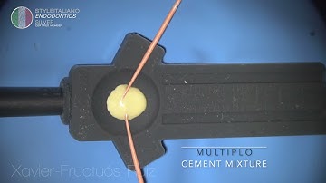 Mix cement and adjust Guttapercha cone legnth with Multiplo & Mirror