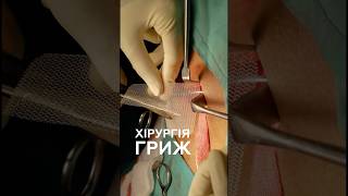 Хірургія гриж - герніопластика