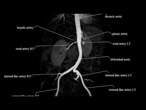 Video: Mat Som En Trigger För Abdominal Angioödemattacker Hos Patienter Med ärftligt Angioödem