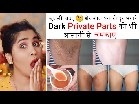 Lighten Dark Vagina, Inner thighs & underarms-Intimate Hygiene Secrets for Vaginal discharge & odour thumbnail