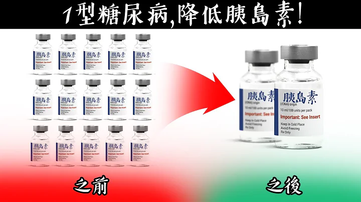 (访谈) 修复1型糖尿病, 降低胰岛素药物使用! 如何断食,柏格医生 Dr Berg - 天天要闻