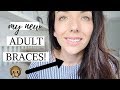 I GOT ADULT BRACES! | CLEAR CERAMIC BRACES | BEFORE AND AFTER