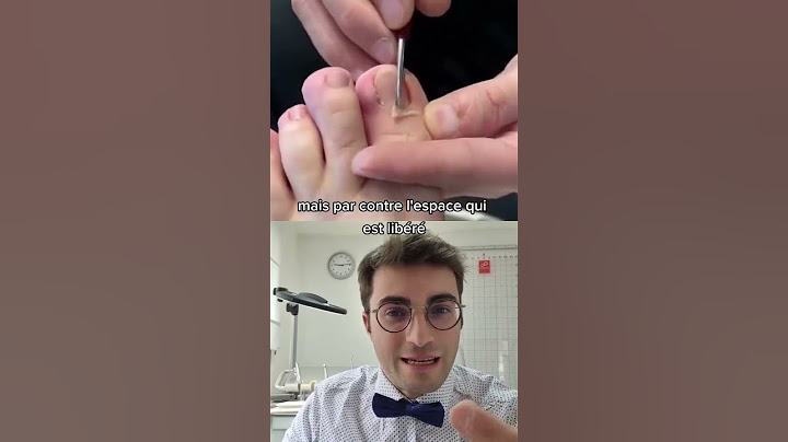 Ongle incarné : NE FAITES PAS ça chez vous !