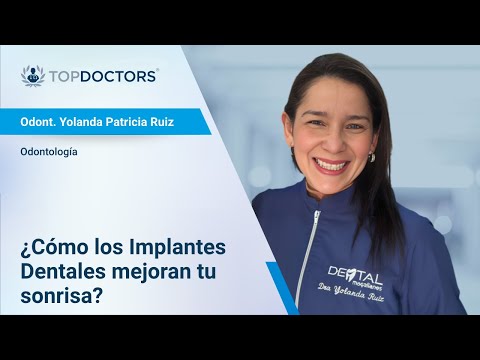 ¿Cómo los Implantes Dentales mejoran tu sonrisa?