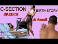 Csection birth story  breech  small baby  honest experience