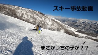 『スキー事故』【栂池高原スキー場】2021.12.31-2022.1.3 Ｐａｒｔ2  大クラッシュ