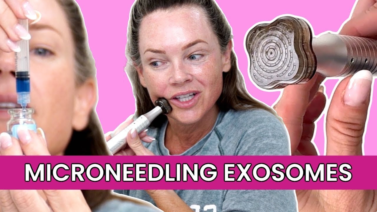 Может ли микронидлинг с экзосомами устранить морщины?
