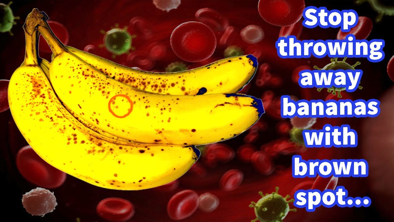 Stop throwing away bananas with brown spots – they are potent cancer fighters!