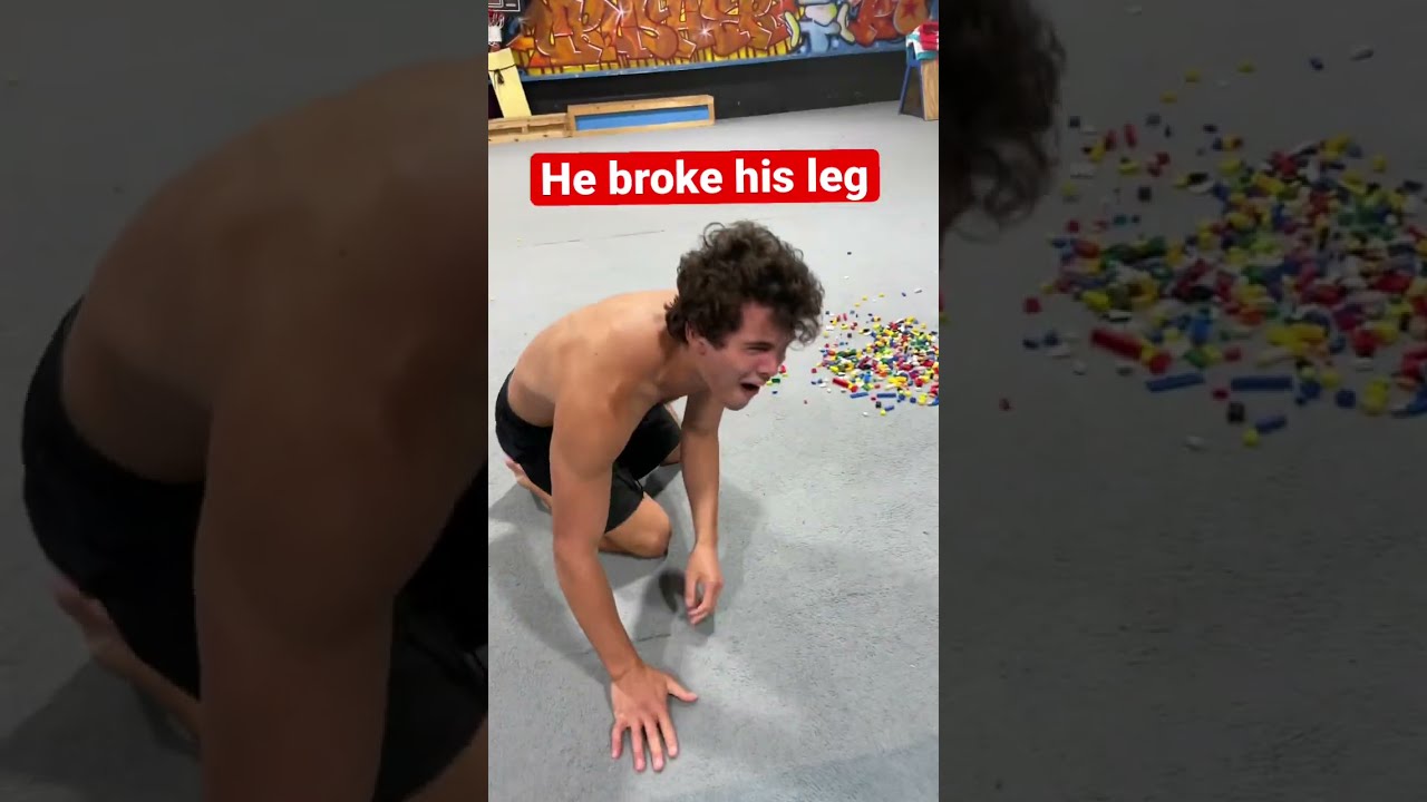 HE BROKE HIS LEG