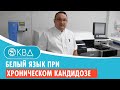 👅 Белый язык при хроническом кандидозе. Клинический случай №864