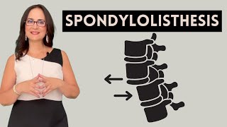 SPONDYLOLISTHESIS คืออะไรและมีการรักษาอย่างไร? Dr Furlan ตอบคำถาม 5 ข้อในวิดีโอนี้