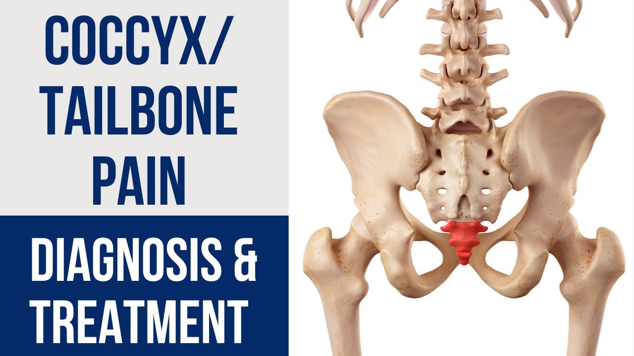 Tailbone (Coccyx) Pain RELIEF, vertebral column