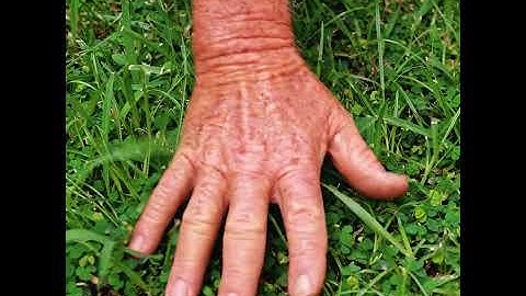 Clover in lawn - why is it there and how to control it