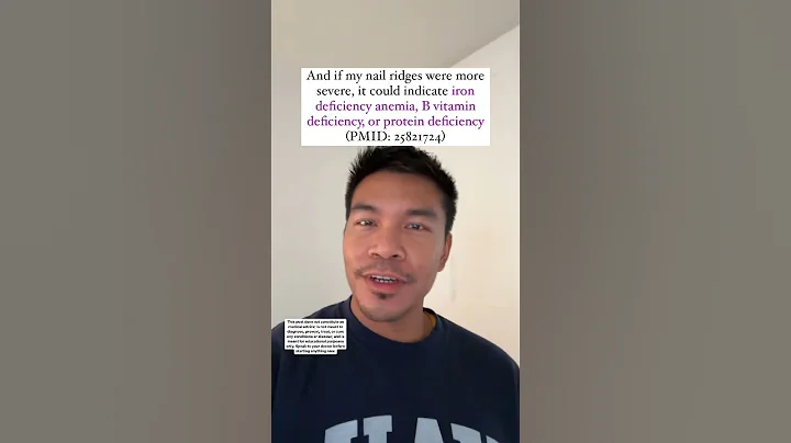 What iron deficiency & vitamin deficiency can do to nails | Part 1 on TikTok: @dr.bryant.nd