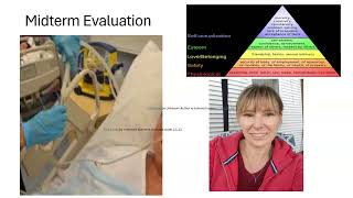 3351 feedforward video