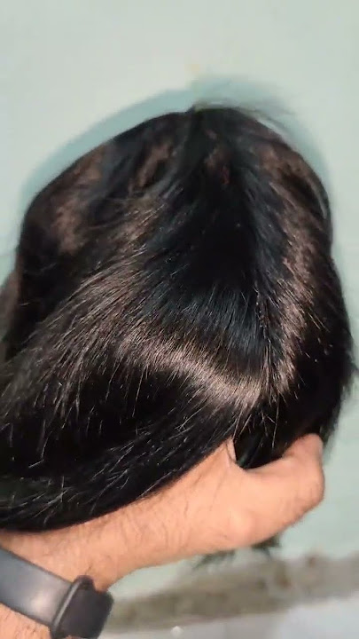 new hair club non surgical hair patch 10500,mei lagwae Faisalabad 03457945144, Pakistan 👌
