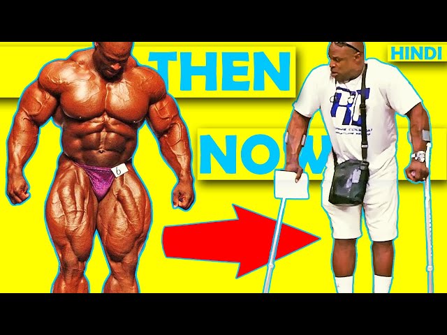 [HINDI] WHAT HAPPENED TO RONNIE COLEMAN ? THEN u0026 NOW 2023 class=