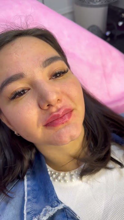 Увеличение губ сложной формы называется Чайка и отзыв от нашей Модели 🥰 ...