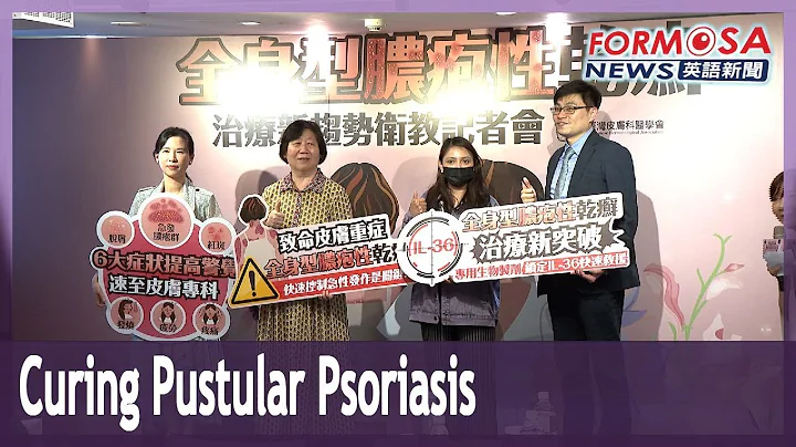New treatments bring hope to pustular psoriasis patients