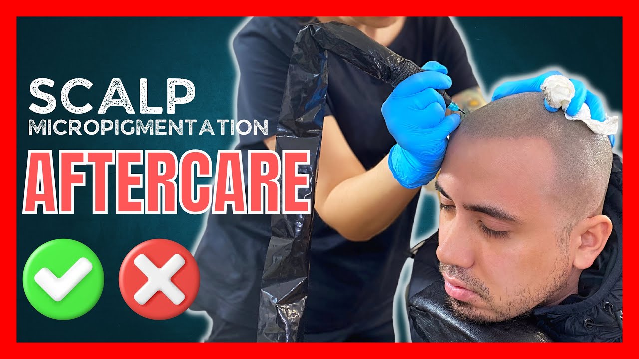 Scalp Micropigmentation AFTERCARE Advice | SMP FAQs