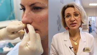 Безоперационная ринопластика Безоперационная ринопластика