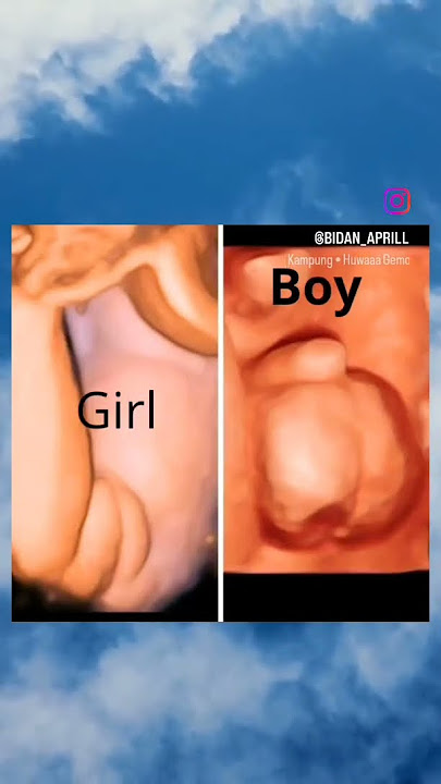 jenis kelamin janin ketika usg #baby #lahiran #