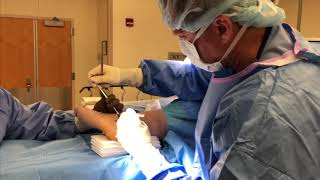 Ankle Surgery-Ankle Arthroscopy (Scope) and Lateral Ligament Repair