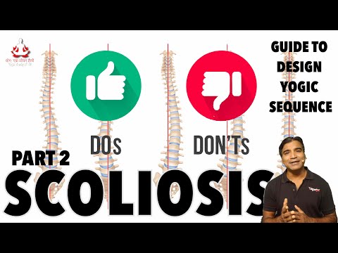 Scoliosis Part 2  | Do's & Dont's | Anatomy Simplified