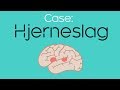 Case 5: Hjerneslag