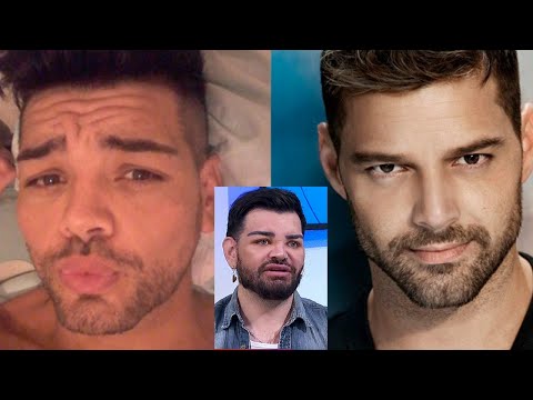 Fran Mariano contó los detalles de las cirugías que se hizo para parecerse a Ricky Martin