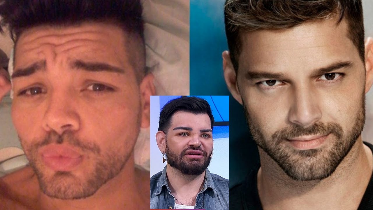 Fran Mariano contó los detalles de las cirugías que se hizo para parecerse a Ricky Martin