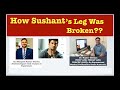 कैसे टूटी Sushant के पैर की हड्डी || How His leg was broken?? || More Evidences