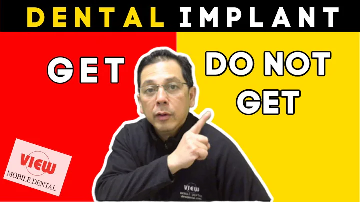 You DO NOT Have to Have Dental Implant -  Options to Replace Missing Teeth | View Mobile Dental
