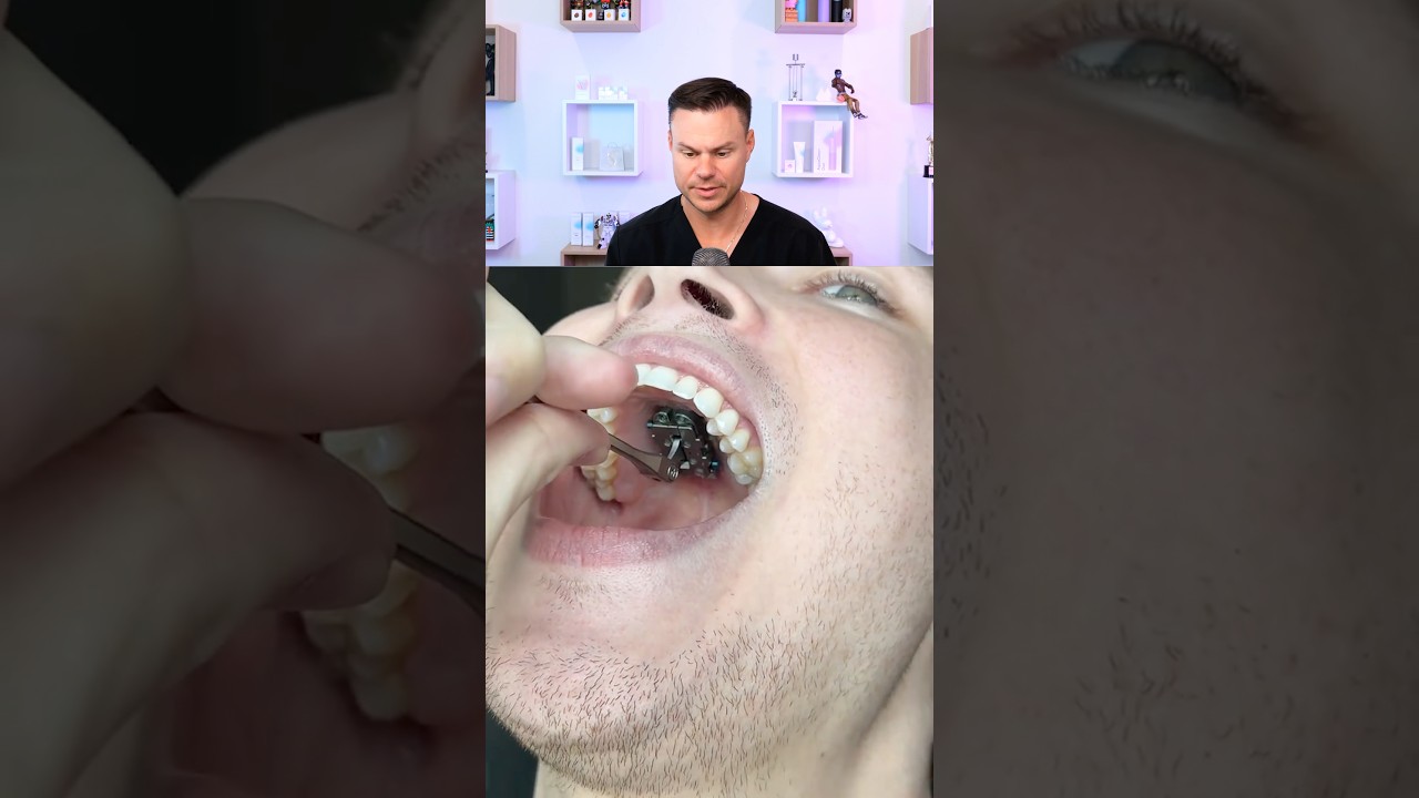 How Dental Technology Is ADVANCING! 😮🦷