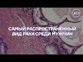 Рак простаты - самый частый &quot;мужской&quot; рак. Симптомы, причины, лечение.