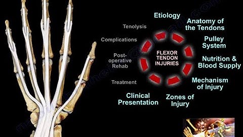 Flexor Tendon Injuries - Everything You Need To Know - Dr. Nabil Ebraheim