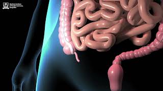 Inflammation of Appendix - Animation @doctorsinstituteofhealthsc9313