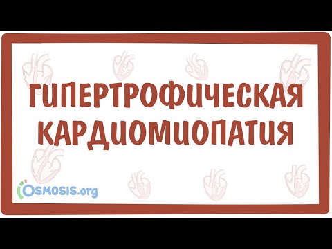 Гипертрофическая кардиомиопатия — причины, симптомы, патогенез, диагностика, лечение