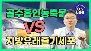 📹자가 골수 흡인농축물 치료 ㅣ골수 유래 vs 지방 유래 [1편]