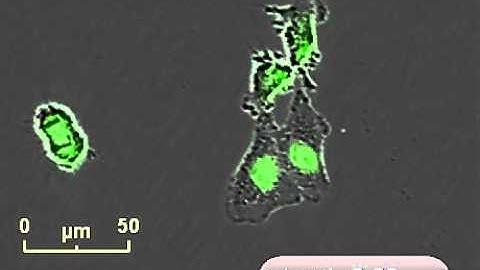 Essen BioScience - CelPlayer Proliferation Assay Using NucLight Green A549_H3_1.avi