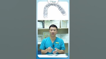 Tại Sao Niềng Răng Invisalign Lại Phù Hợp Với Người Bận Rộn | Bác Sĩ Yên