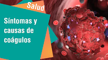 ¿Cuáles son los primeros síntomas de un coágulo de sangre?