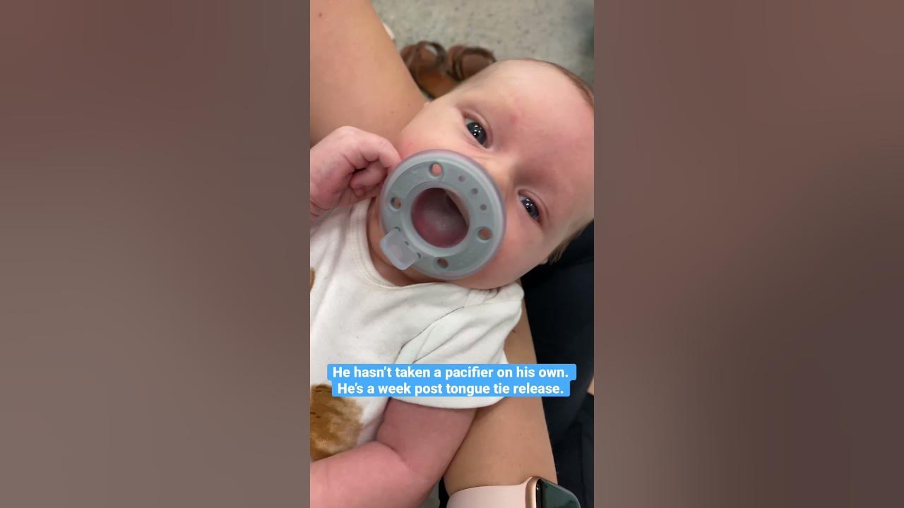 I love this pacifier for training after a tongue tie release. YouTube